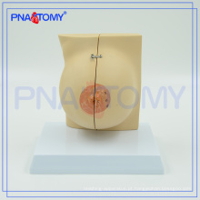 PNT-0747 modelo anatômico da mama em tamanho natural